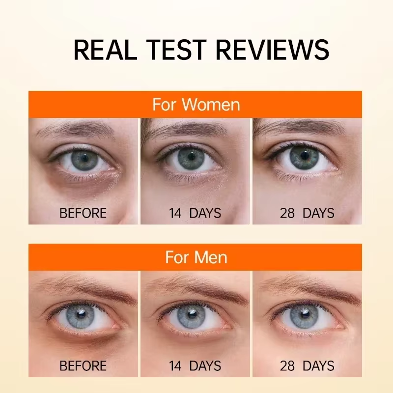 Anti Dark Circle Eye Serum Oil - Caffeine Eye Serum 评论和价格