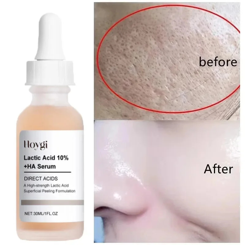 Lactic Acid Shrink Pores Serum - Licorice Root Extract 评论和价格