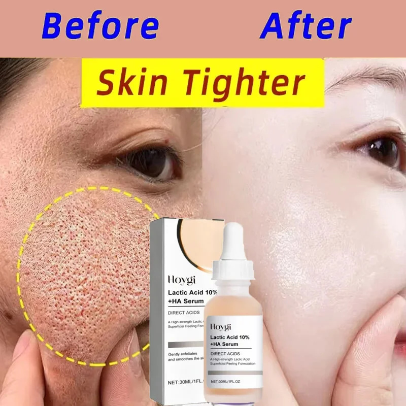 Lactic Acid Shrink Pores Serum - Licorice Root Extract 评论和价格
