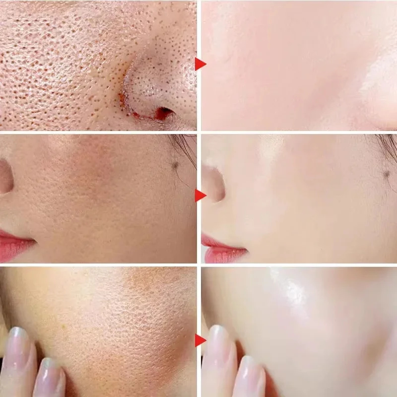 Lactic Acid Shrink Pores Serum - Licorice Root Extract 评论和价格