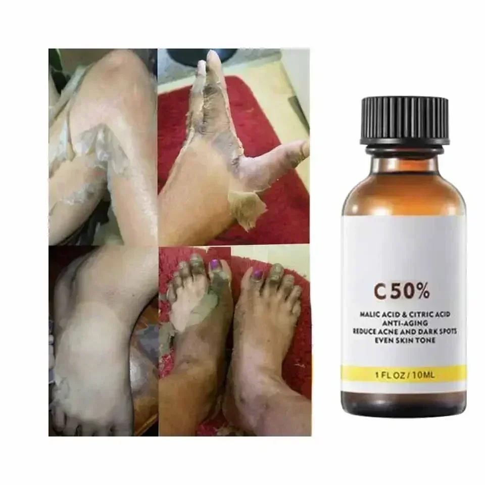 With Malic Acid And Citric Aci - Licorice Root Extract 评论和价格